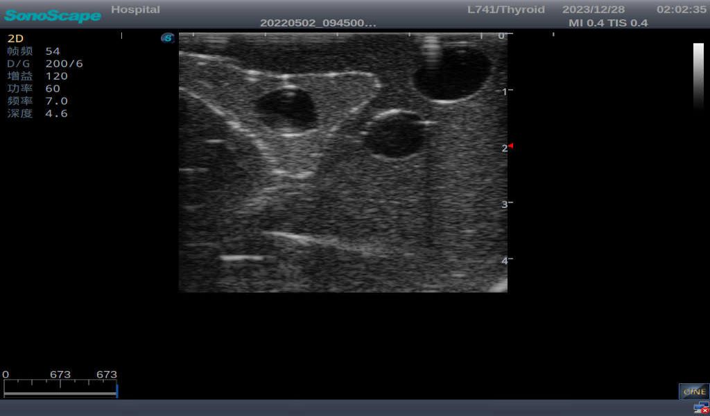 Thyroid Ultrasound Training Model